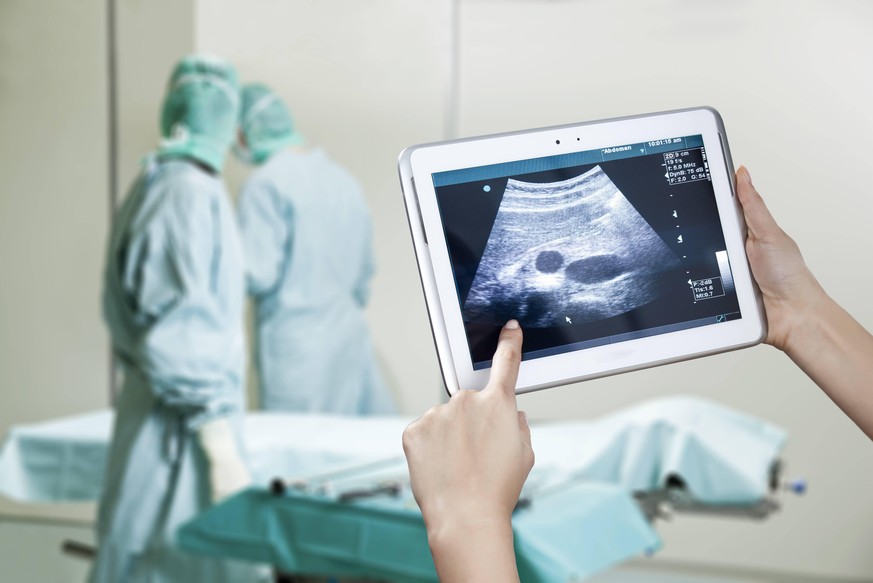 Hands holding digital tablet with ultrasound image in operating theatre model released Symbolfoto PUBLICATIONxINxGERxSUIxAUTxHUNxONLY MFF003064